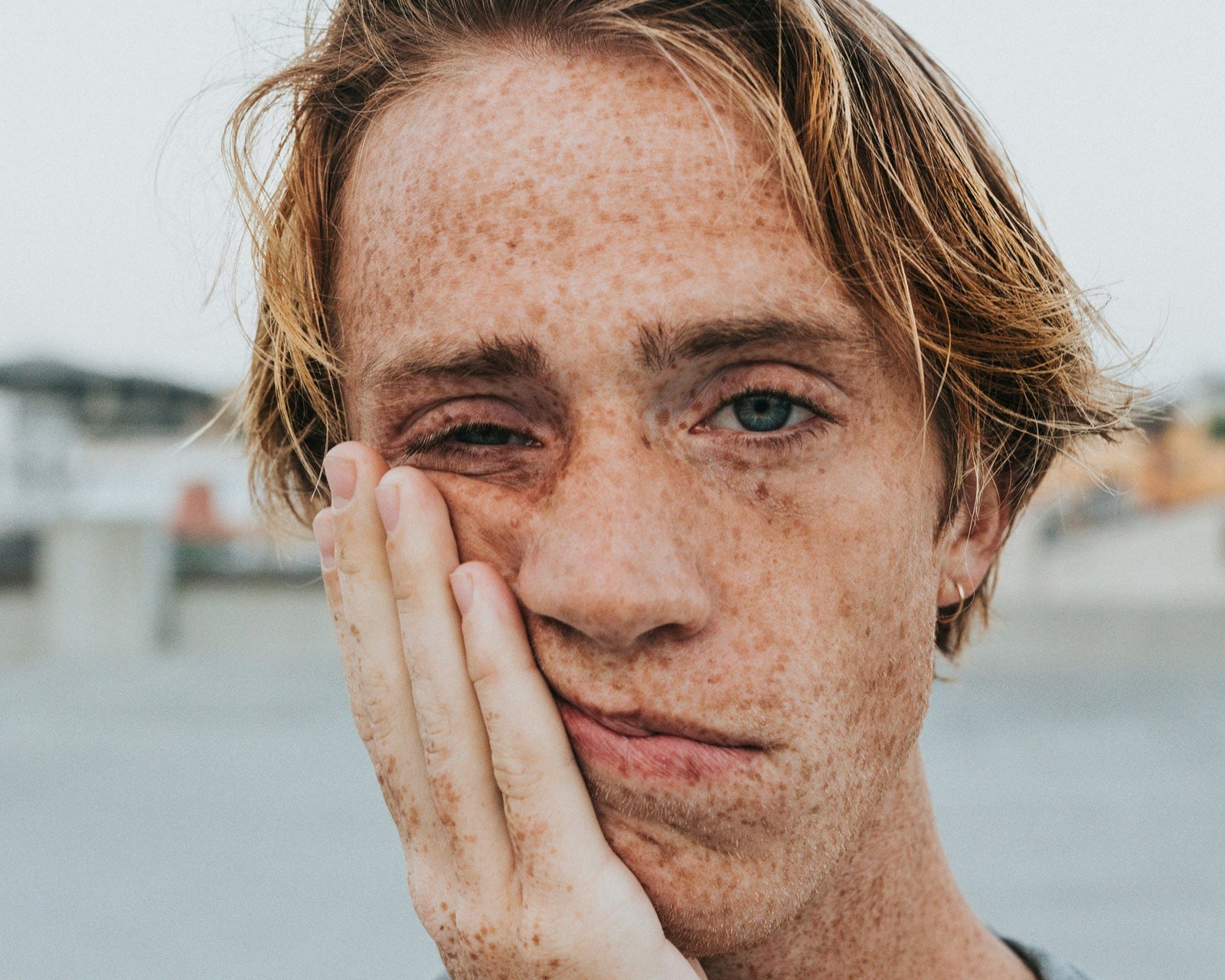 SENSITIVE SKIN DESERVES SUMMER TOO